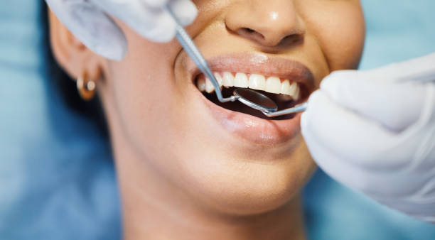 Best Emergency Dentist for Knocked-Out Tooth in Bernie, MO